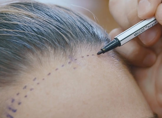 Microscopi per chirurgia e trapianti
